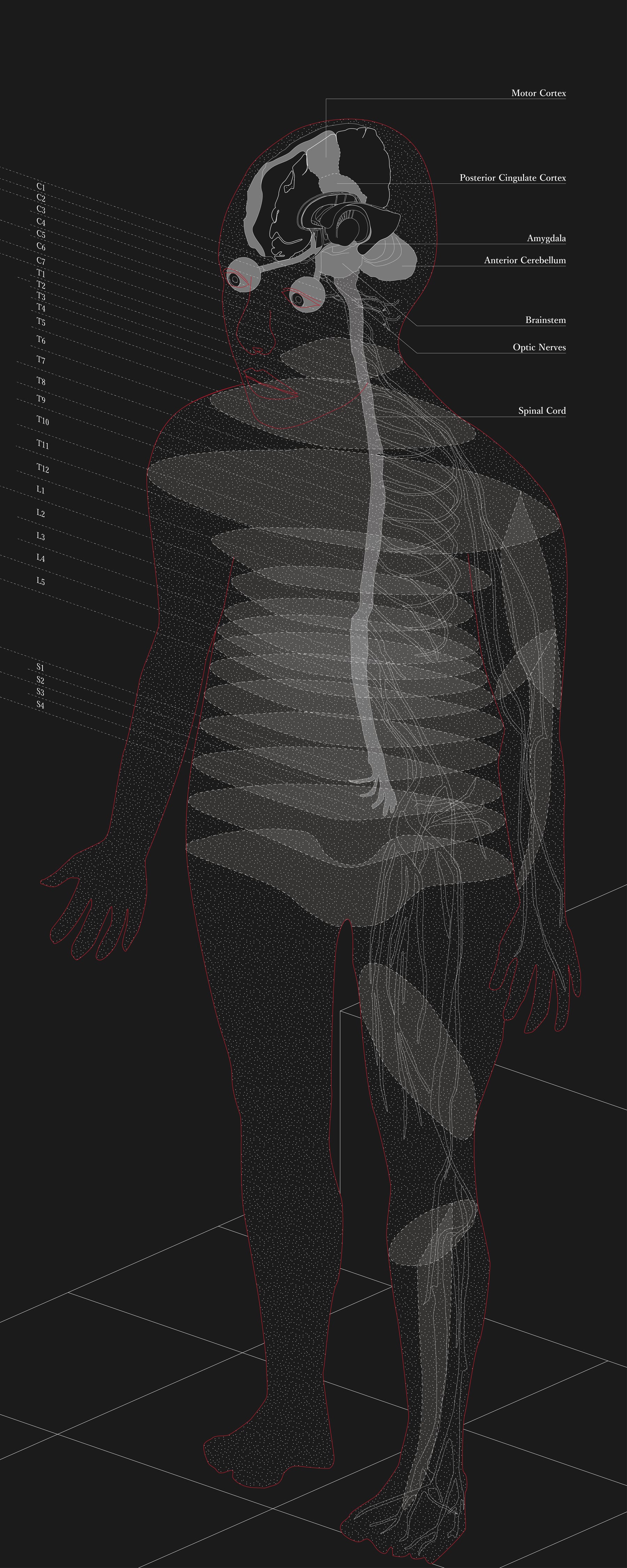 Accidental Certainty still